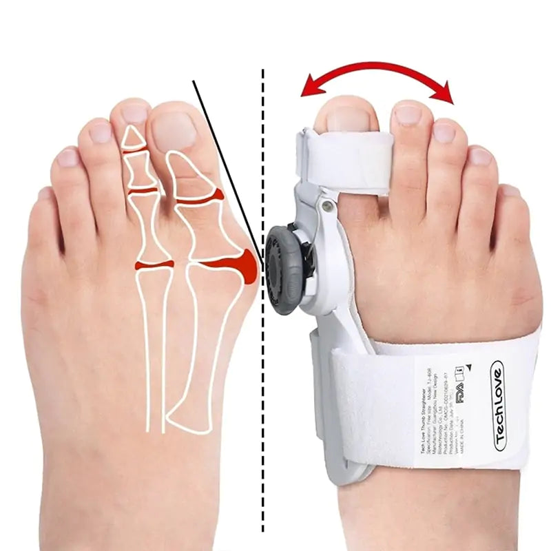 Adjustable Bunion Corrector